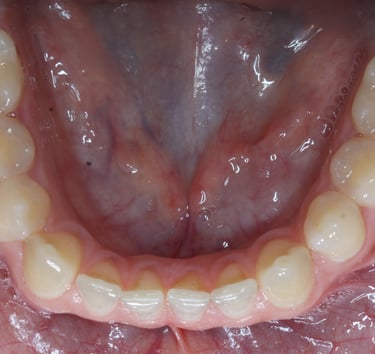 pictures of teeth