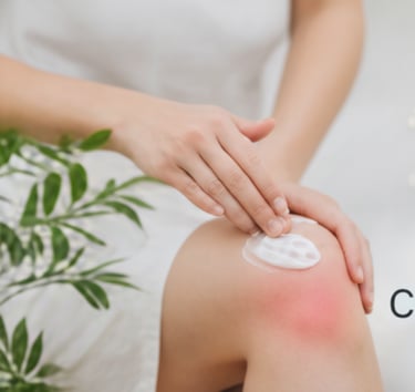 Person's hands applying a white cream to their knee which appears red from inflammation.