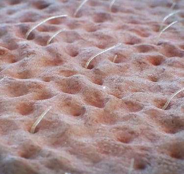 microscopic close up of part of skin with hair and pores