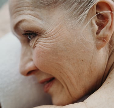 tratamientos para eliminar las arrugas en Murcia. Clinica Estética iMujer. Pilar Soriano Lucas Egea