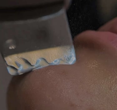 Limpeza de pele em bh