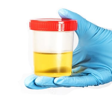 Urinary Tract Infection, Burning, Pee, Urine, Frequency, Antibiotics, Tests, Testing, UTI
