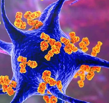 Autoimmune positive plasma