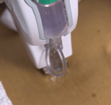Mesoterapia sem agulha