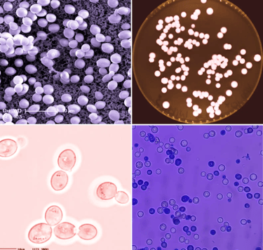 Yeast under the  microscope