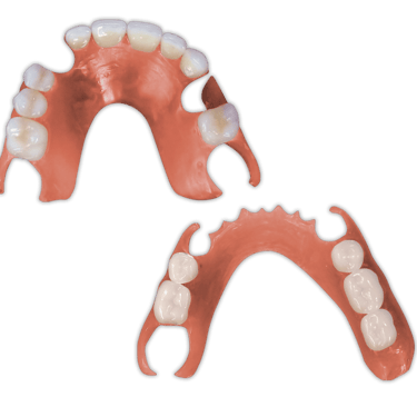 Protesis-Removible-Flexible-PartialFlex