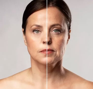 Profhilo: tratamento inovador para hidratação profunda e firmeza da pele na clínica estética em Setú