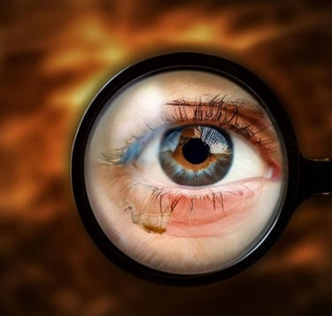 Diabetic-retinopathy-nexus-vision-secunderabad