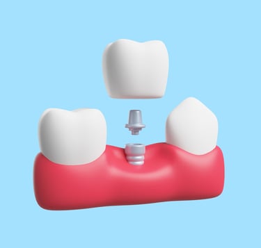 Fixed denture