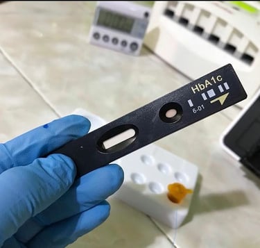 hbA1c for diabetes