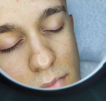 Arckezelés utáni bőr Veszprém