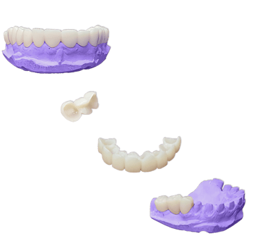 Protesis-Fija-Provisional-Acrilico-Rapido