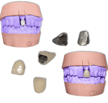 Protesis Fija Metal Ceromero Signum