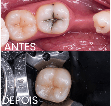 Clínica especializada em dentisteria e tratamento de cáries em Setúbal.
