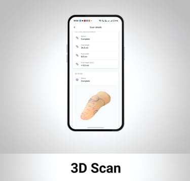 BenX O&P digital design platform- 3D scan