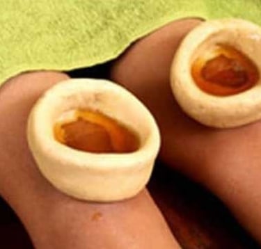Janu Basti at HLC Ayurveda nature cure, bengaluru