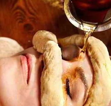 netra tharpana at HLC Ayurveda nature cure, bengaluru