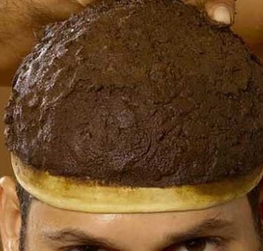 Thalapothichil at HLC Ayurveda nature cure, bengaluru