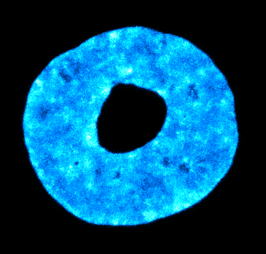 Fluorescent image of a toroidal nucleus.