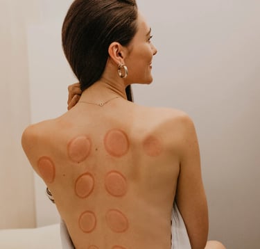 Terapia com Ventosas