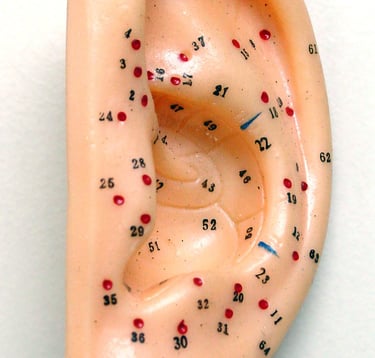 Auriculoterapia