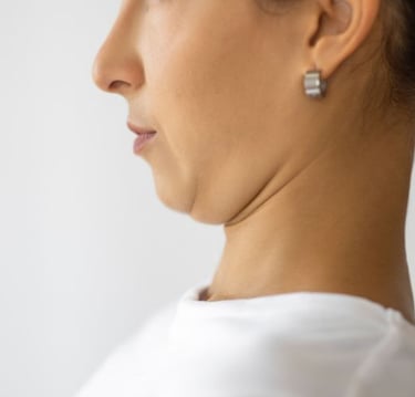 woman doing a chin tuck