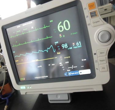 monitor de signos vitales con parámetros fisiológicos en pantalla