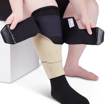 Lymphedema: patient wearing long-term compression garment to manage swelling.