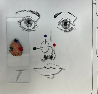 Preparo peça e confecção mapa, Cirurgia Micrográfica de Mohs em Salvador, Bahia