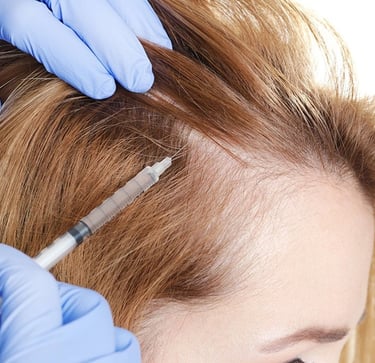 PRP treatment in Vadodara: Expert dermatologist offers the best solution for hair fall. 