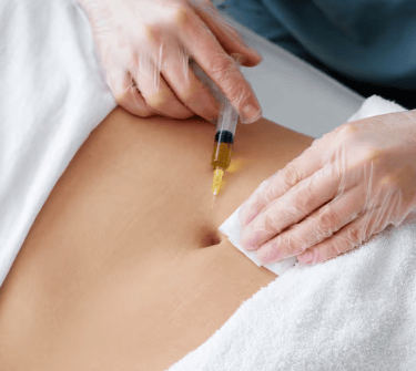Mesoterapia com agulha