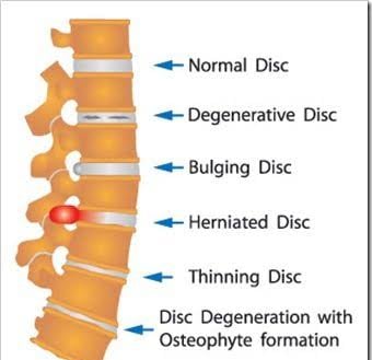 Vetrivel Health center best chiropractic and varamam theraphy 