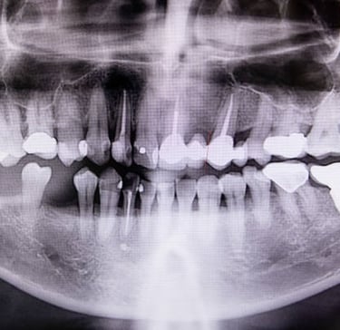 Dental & Vet X-ray Annual Physics Test