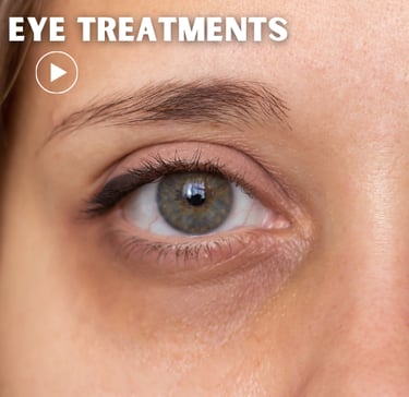 a woman with tired eye 