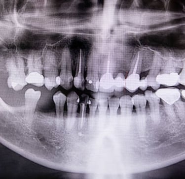 Dental & Vet X-ray Annual Physics Test