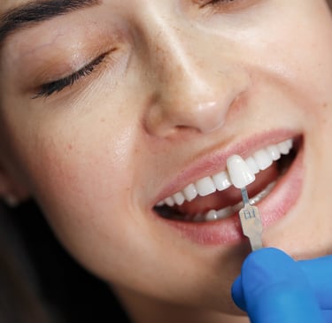Affordable Veneers Navi Mumbai | Ekdantam Dental Clinic