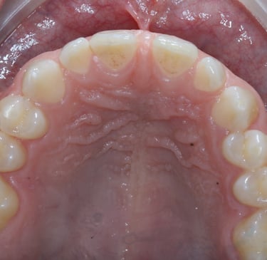 pictures of teeth
