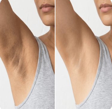 Eficácia comprovada