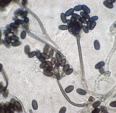 Microscopic view of Stachybotrys chartarum black mold spores and hyphae structures.