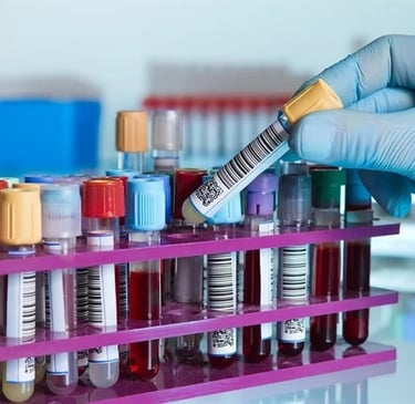 Human serum samples