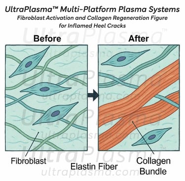 ultra_plasma_ultra_plazma_ultra-plasma_ultra-plazma