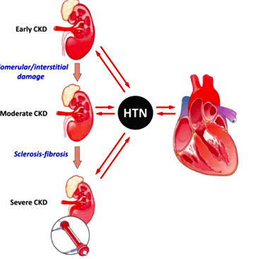 Kidney & Heart disease and their relationship