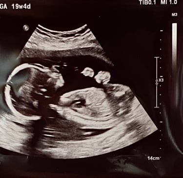 a baby's four month ultrasound scan