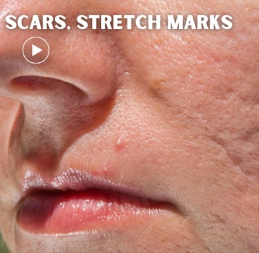 a woman with scars on her face and nose