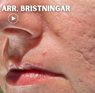 a person with scars in the face