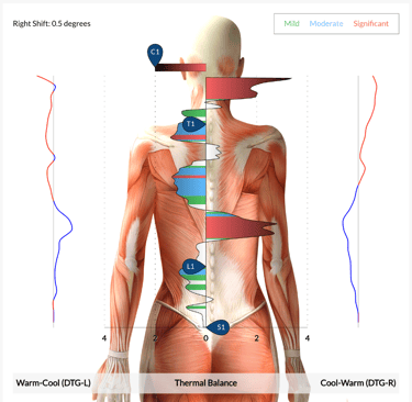 Neurological scans help show Dr. Spencer how and where their nervous system is stressed