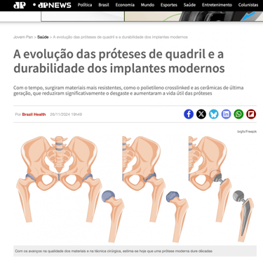 quanto tempo dura uma protese do quadril