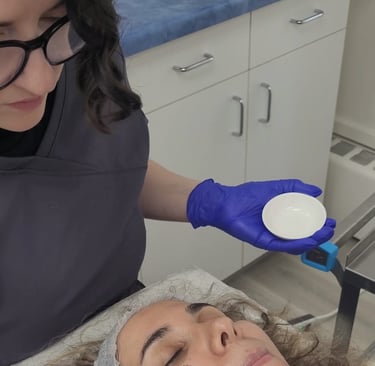 A rejuvenating chemical peel performed on a young client at Ariana Esthetic, Edmonton.