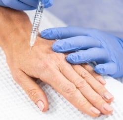 Hand rejuvenation treatments with boosters and fillers