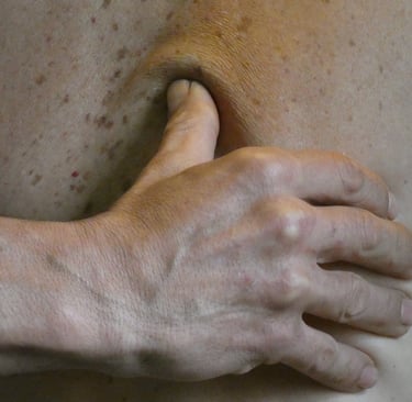 un térapeuthe exerce un impulsion vibratoire sur un trigger point